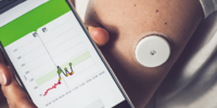 Diabetes mellitus